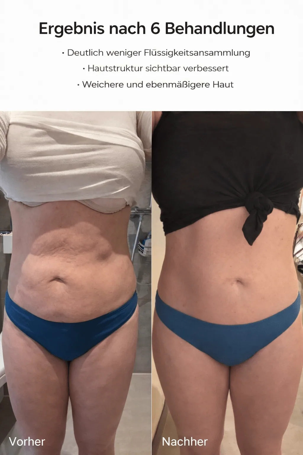 Appareil Lissant et Chauffant Visage